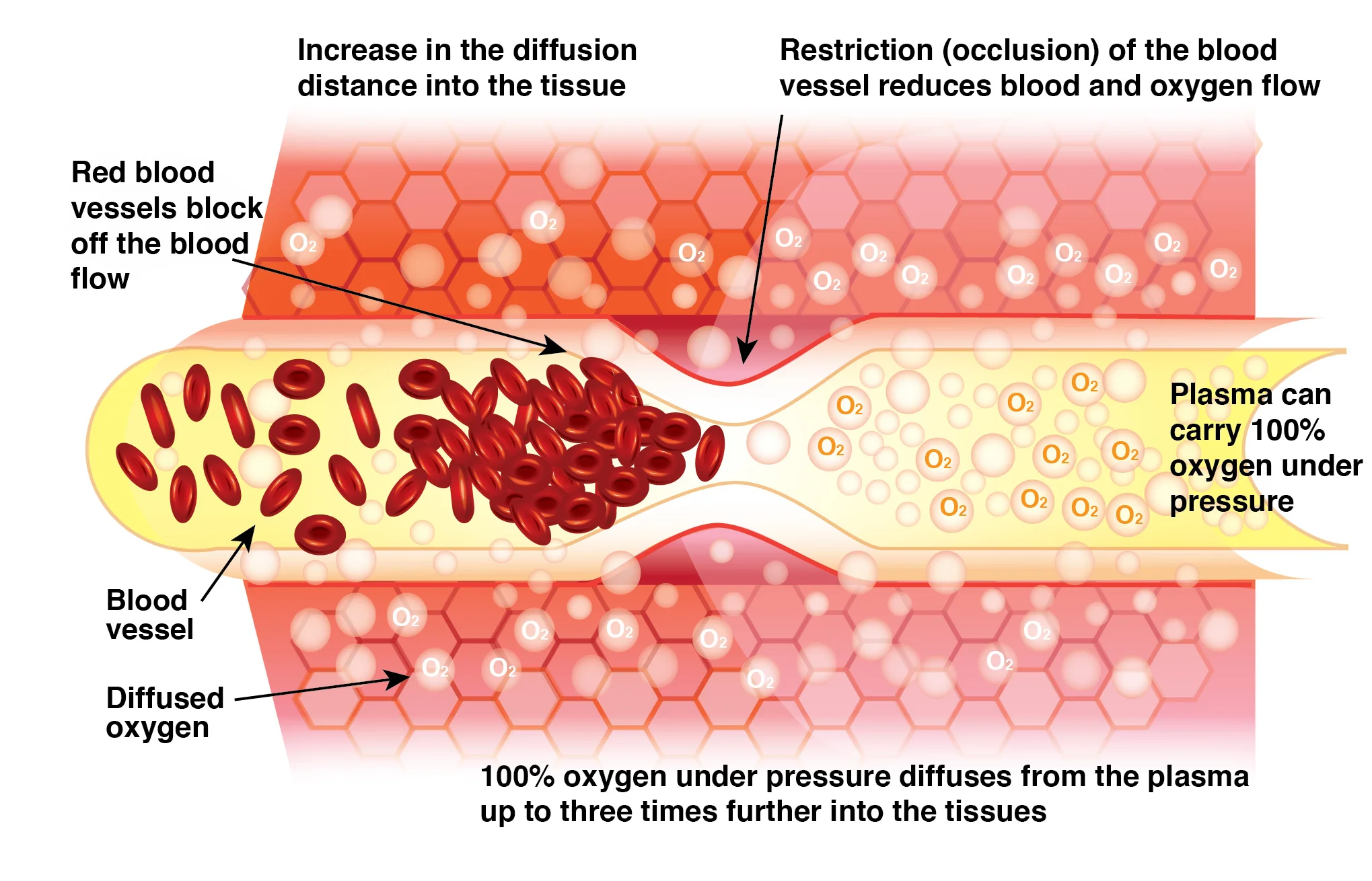 Figure 2 Hyperbaric chamber vessels 2.jpg