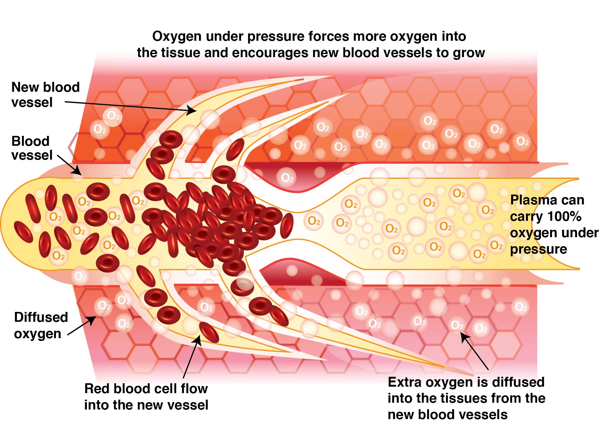 Figure 3 hyperbaric blood .jpg