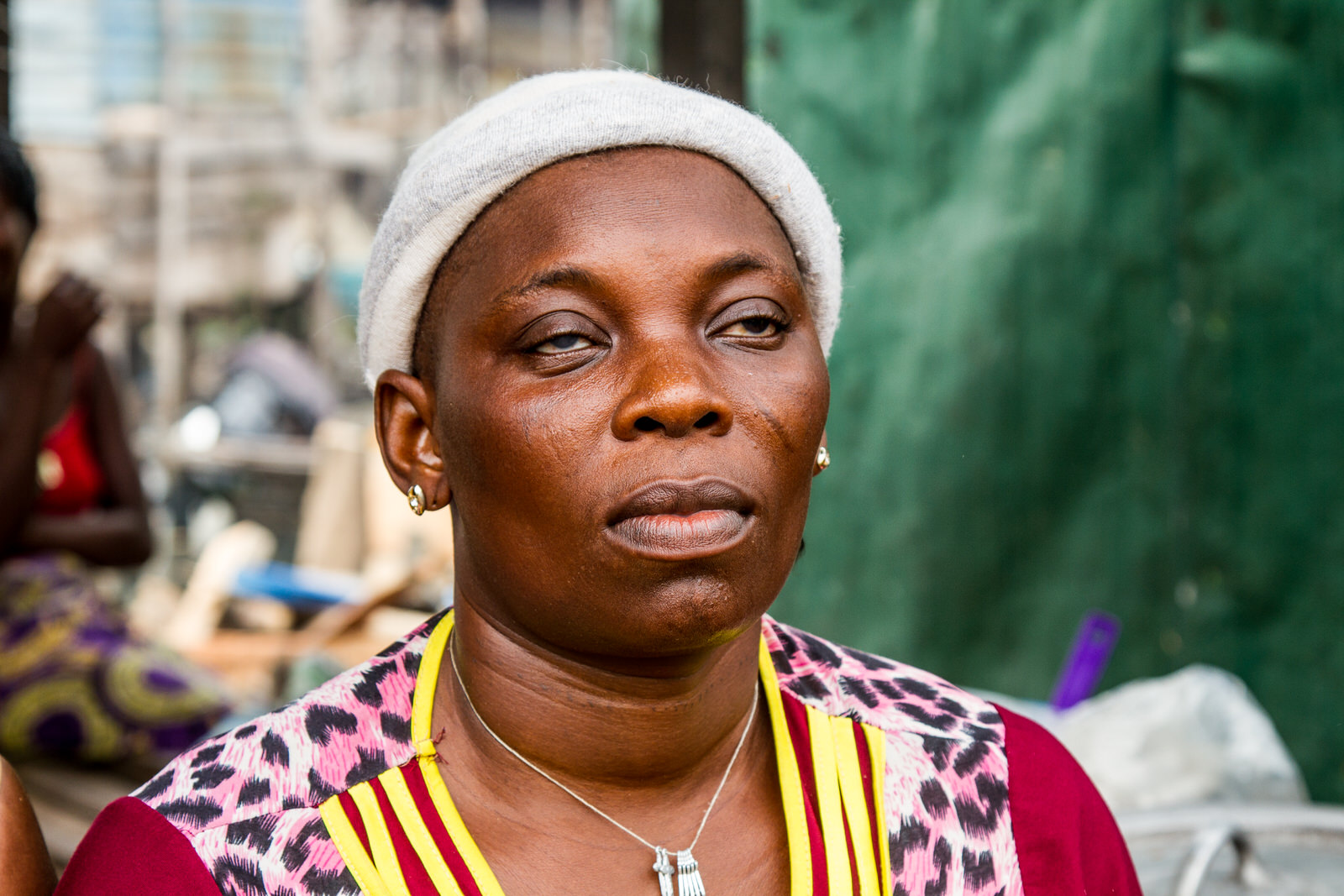 One of the evictees taken in by Janet is Veronica Agbogla. Veronica was blinded by the fires that were lit during the brutal evictions. "I lost my house, all my property, and everything I have laboured for".
