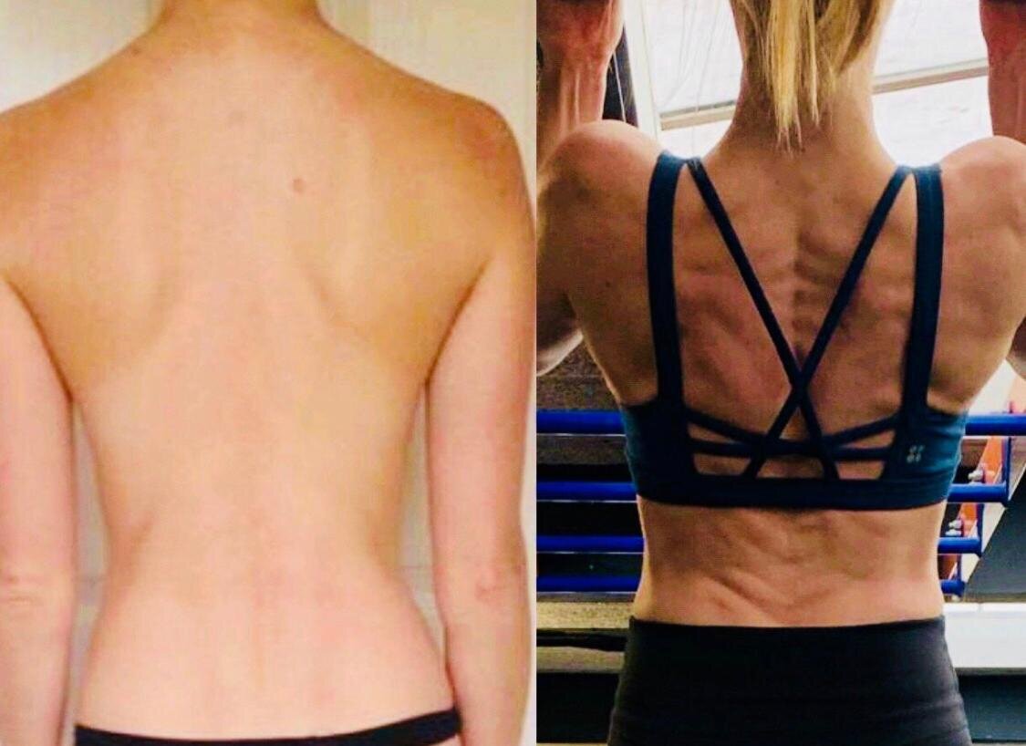 Client 15 before and after.jpg
