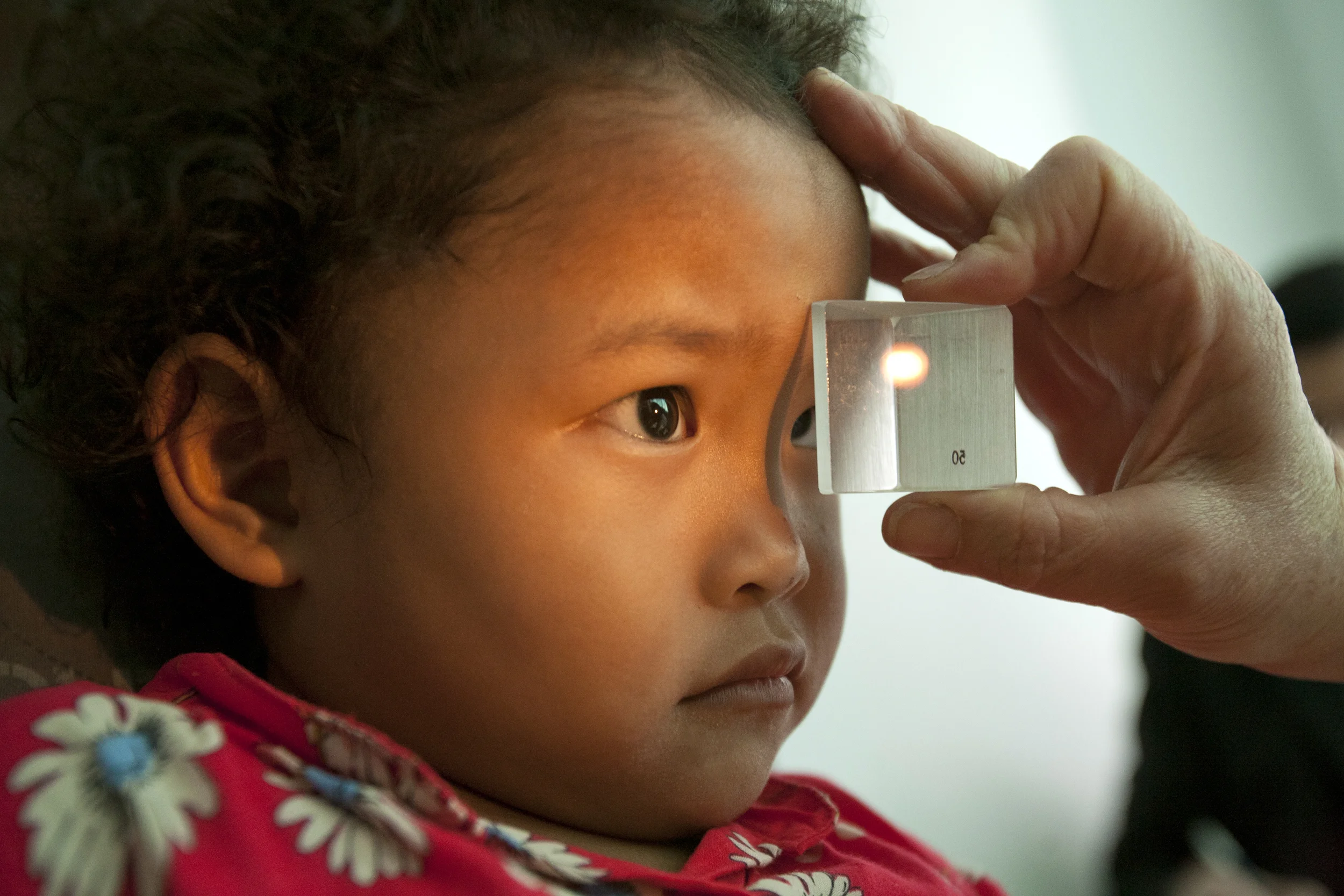 Bugbee-Strabismus-9383.jpg