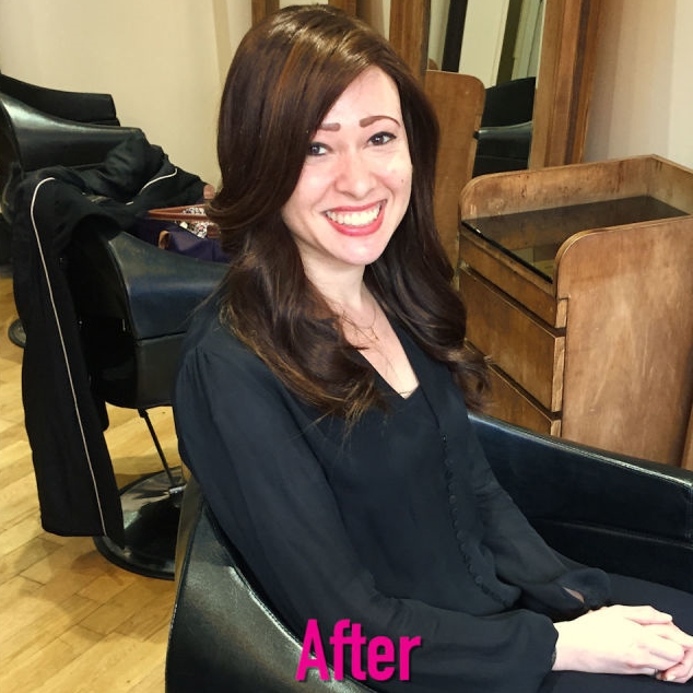 I Have Hair Loss and I Talk About It