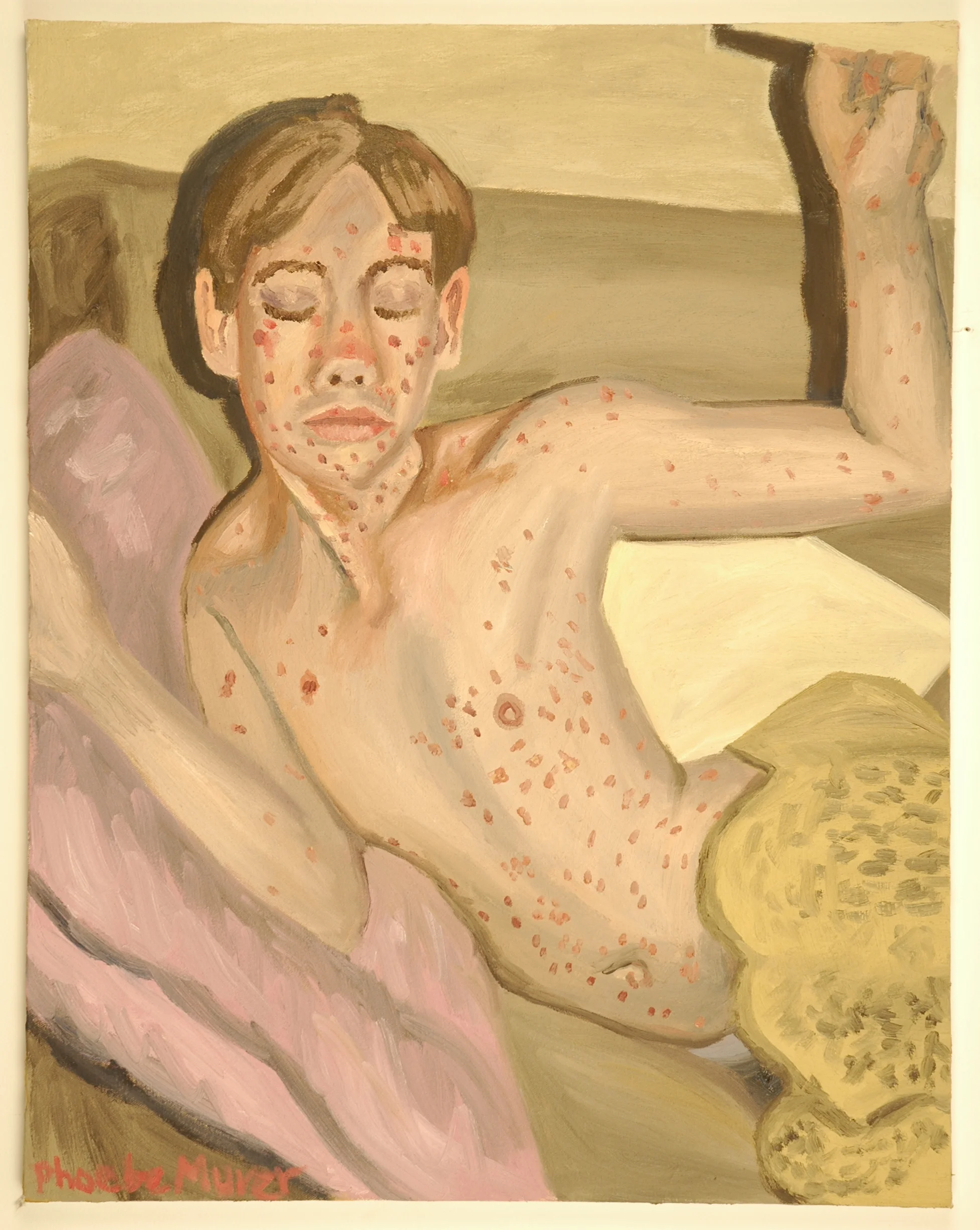 Chicken Pox, 28" x 22", Oil on Canvas, 2008, $400