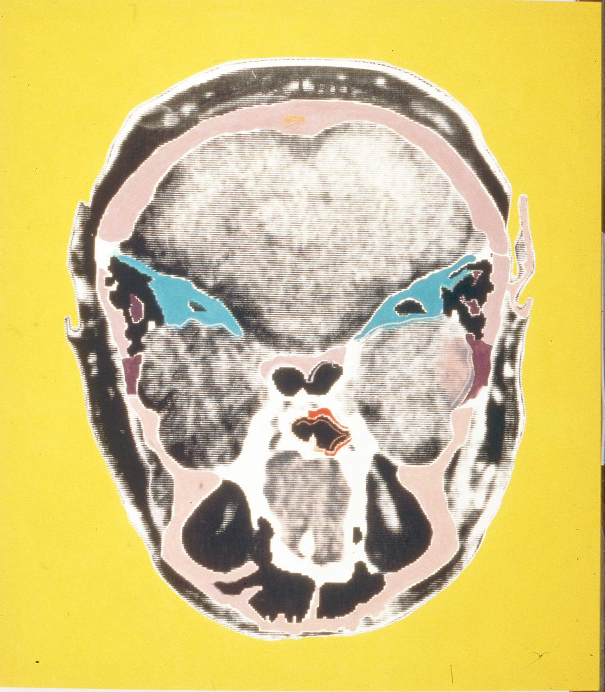  Resonancias de Warhol - Amarillo, 1996  Acrilico y creyón de cera sobre tela impresa  165 x 150 cm 