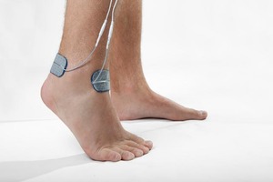 Ankle_pain_electrode_placement_02.jpg