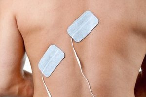 Intercostal%2Bneuralgia.jpg
