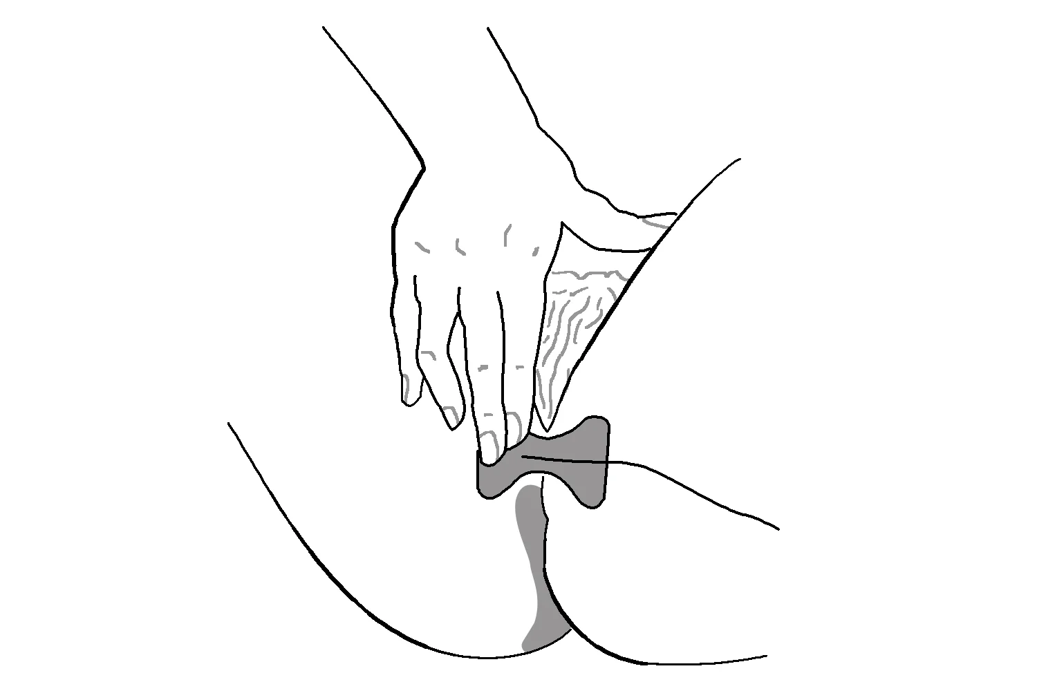 Perineal Female 2.jpg