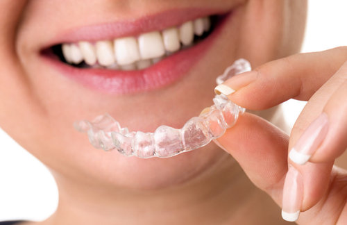 Invisalign Zürich
