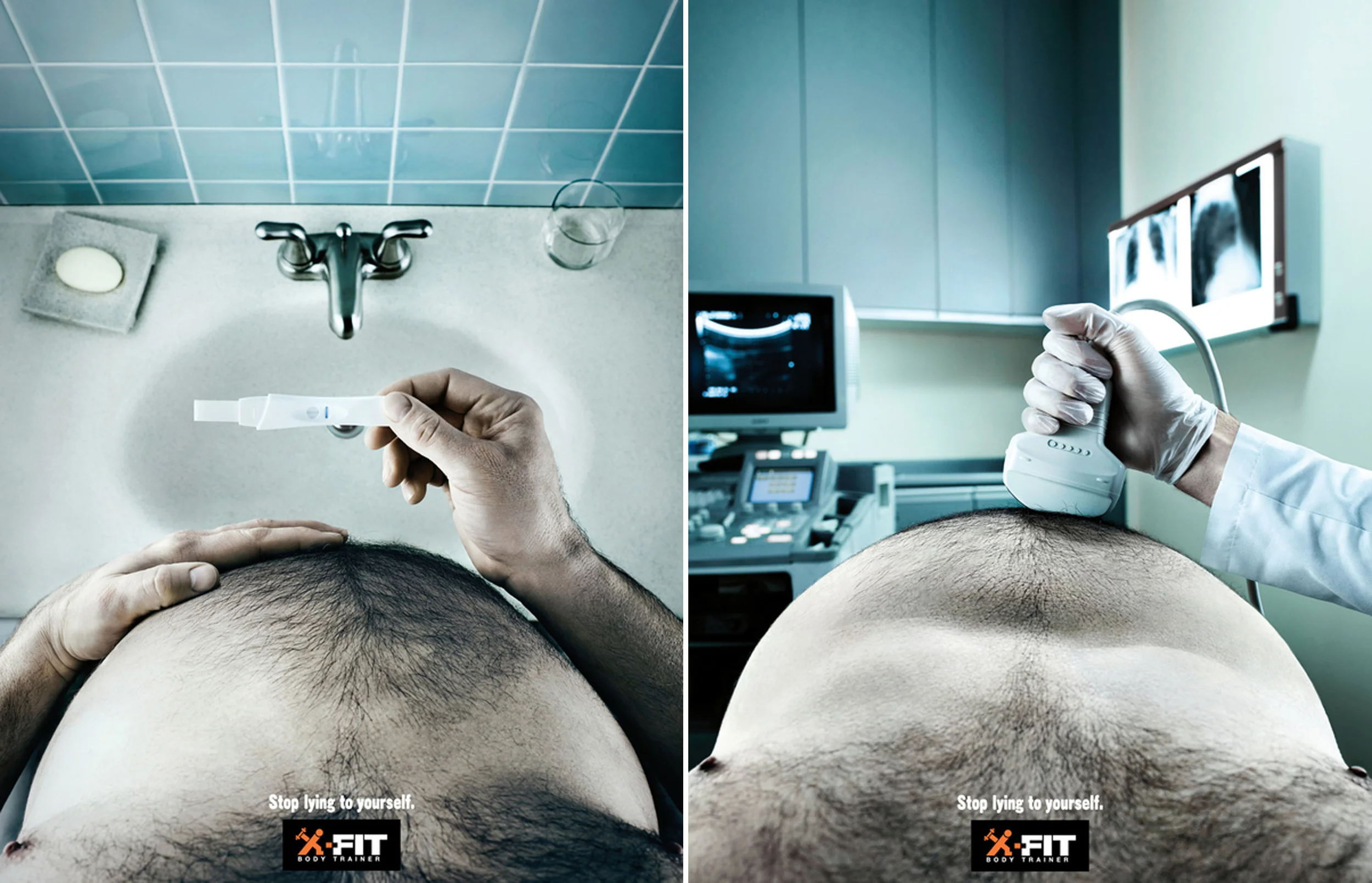 x-fit