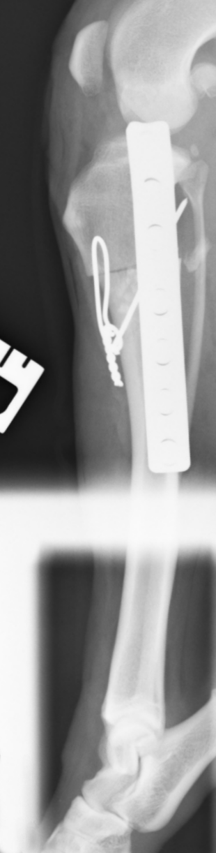 postop-right-side.png