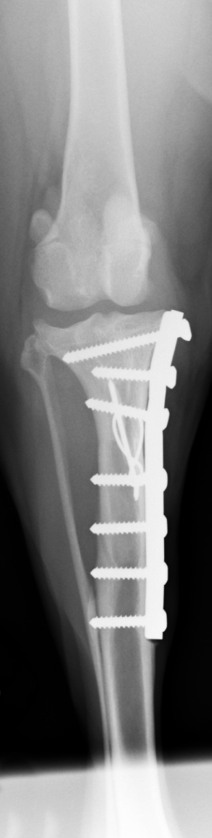 x-ray 1.png