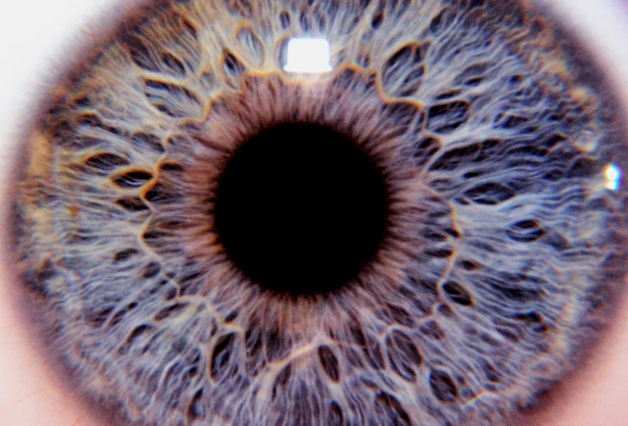 My Eye. (right)
