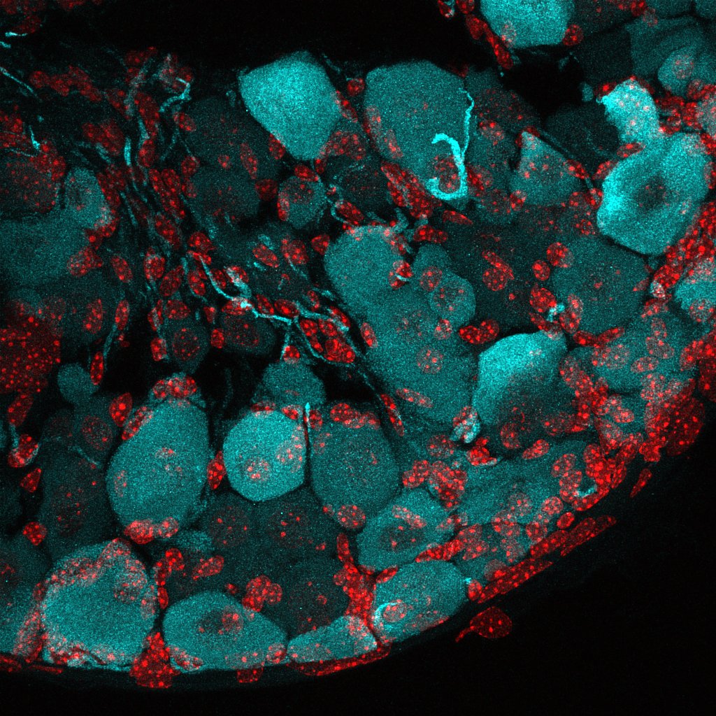 Sensory neurons