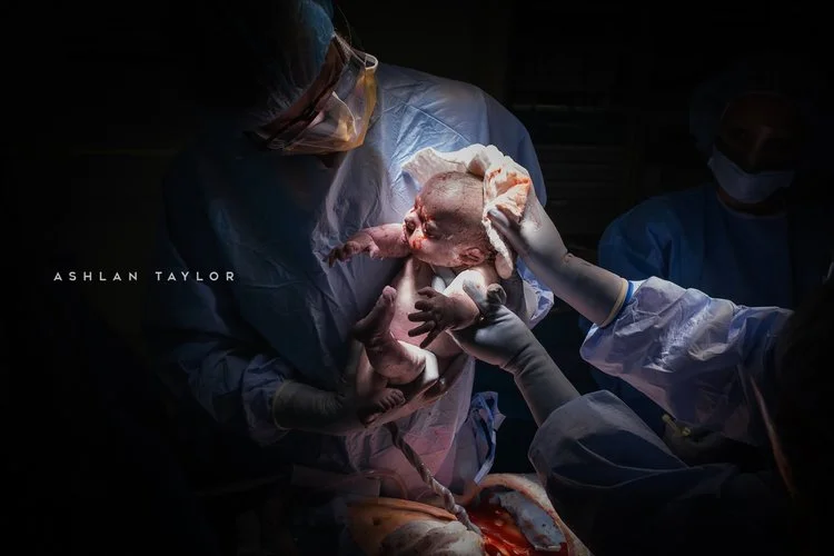 cesarean section birth at Portland hospital 