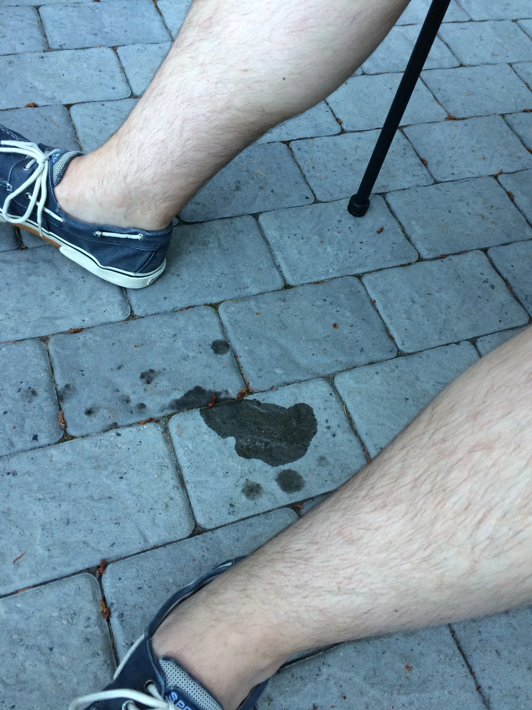 Whoops!