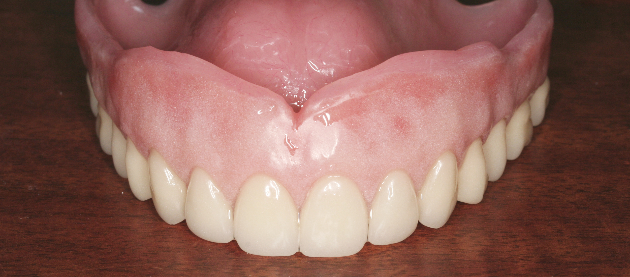 denture.jpg