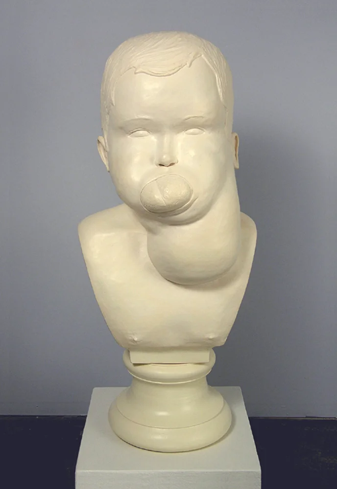 10. Soft Tissue Hypertrophy.jpg