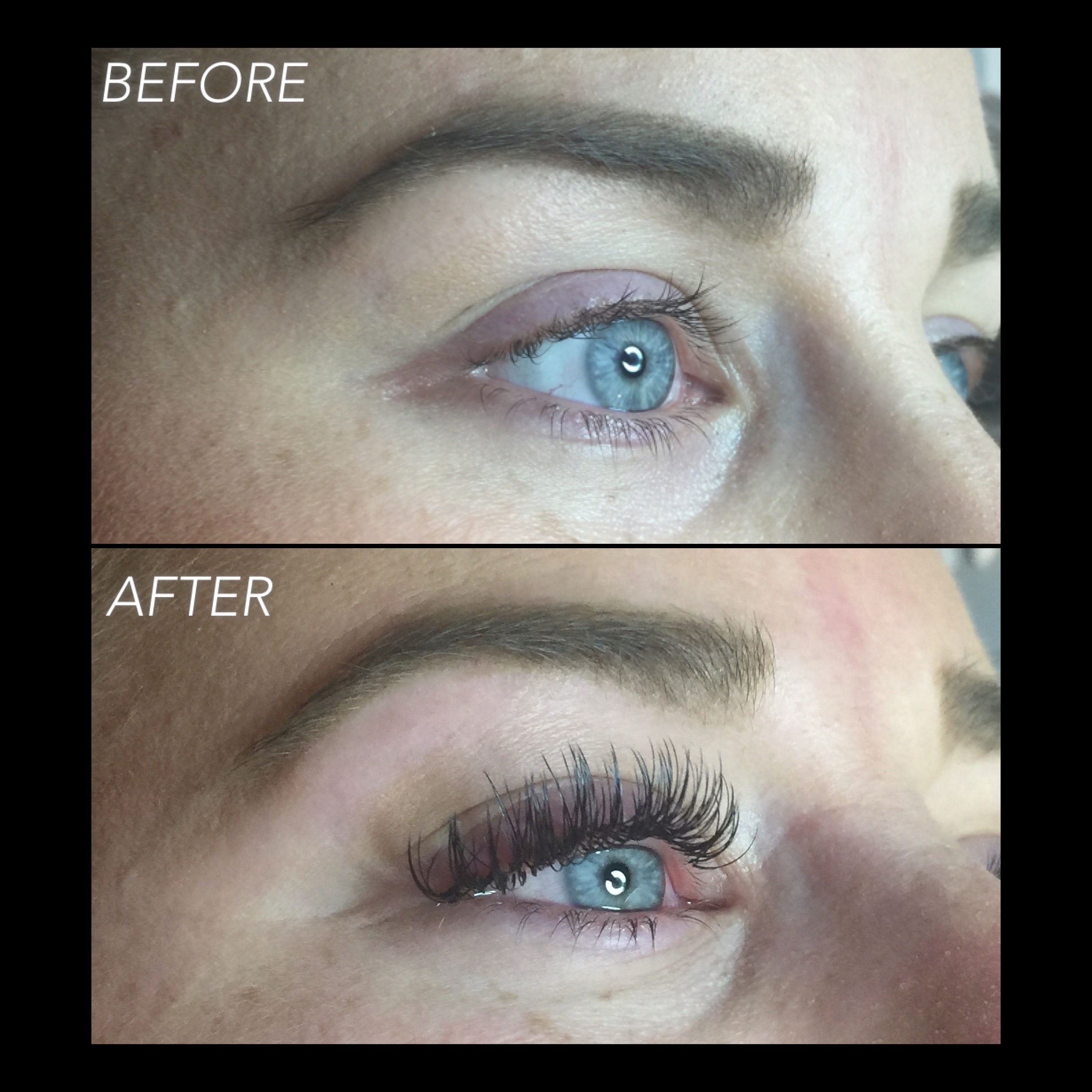 This is the before and after from the picture I used to showcase what damage and improper application looks like. She was a transfer client and I made an executive decision to remove her previous work. Because adhesive remover can cause improper bonding, I had her come back 24 hours later and I applied a fresh new set. Now she has lashes that will live a happy and healthy life!