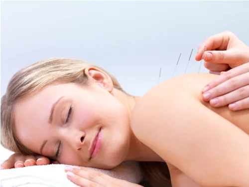 acupuncture-back2.jpg