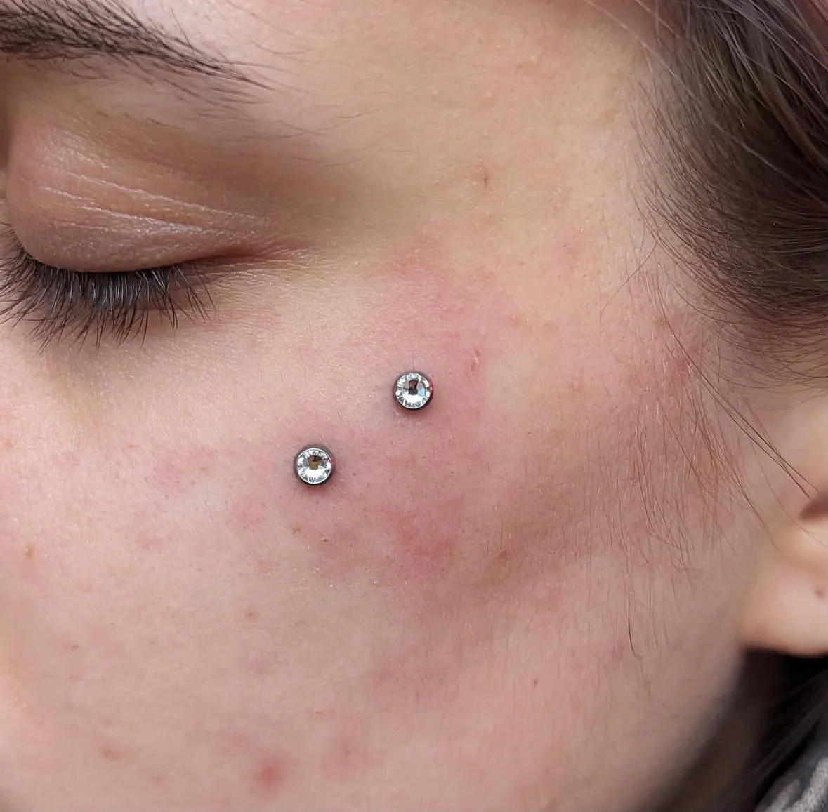 an image of a surface piercing on a ladies cheek with two titanium gem czs which was done at Kilburn Original