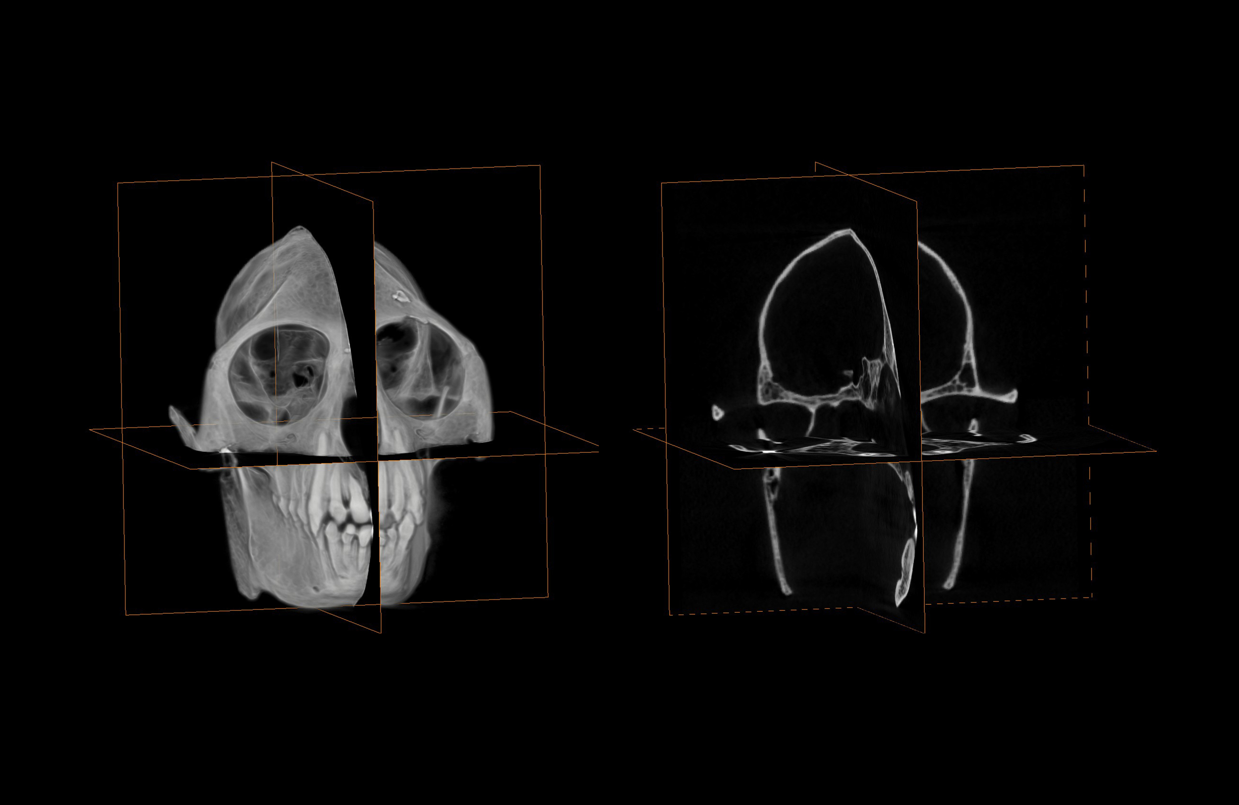 CT scan of skull and associated tomographs