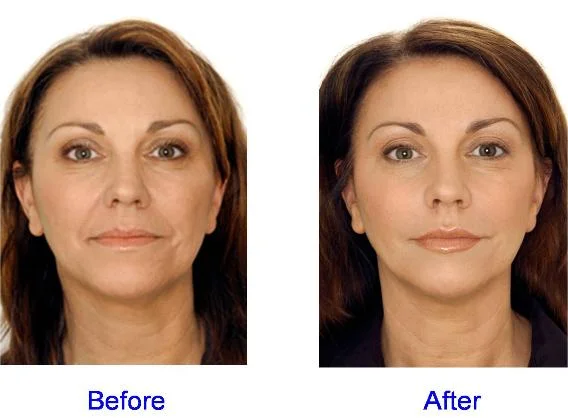Best before and after.jpg