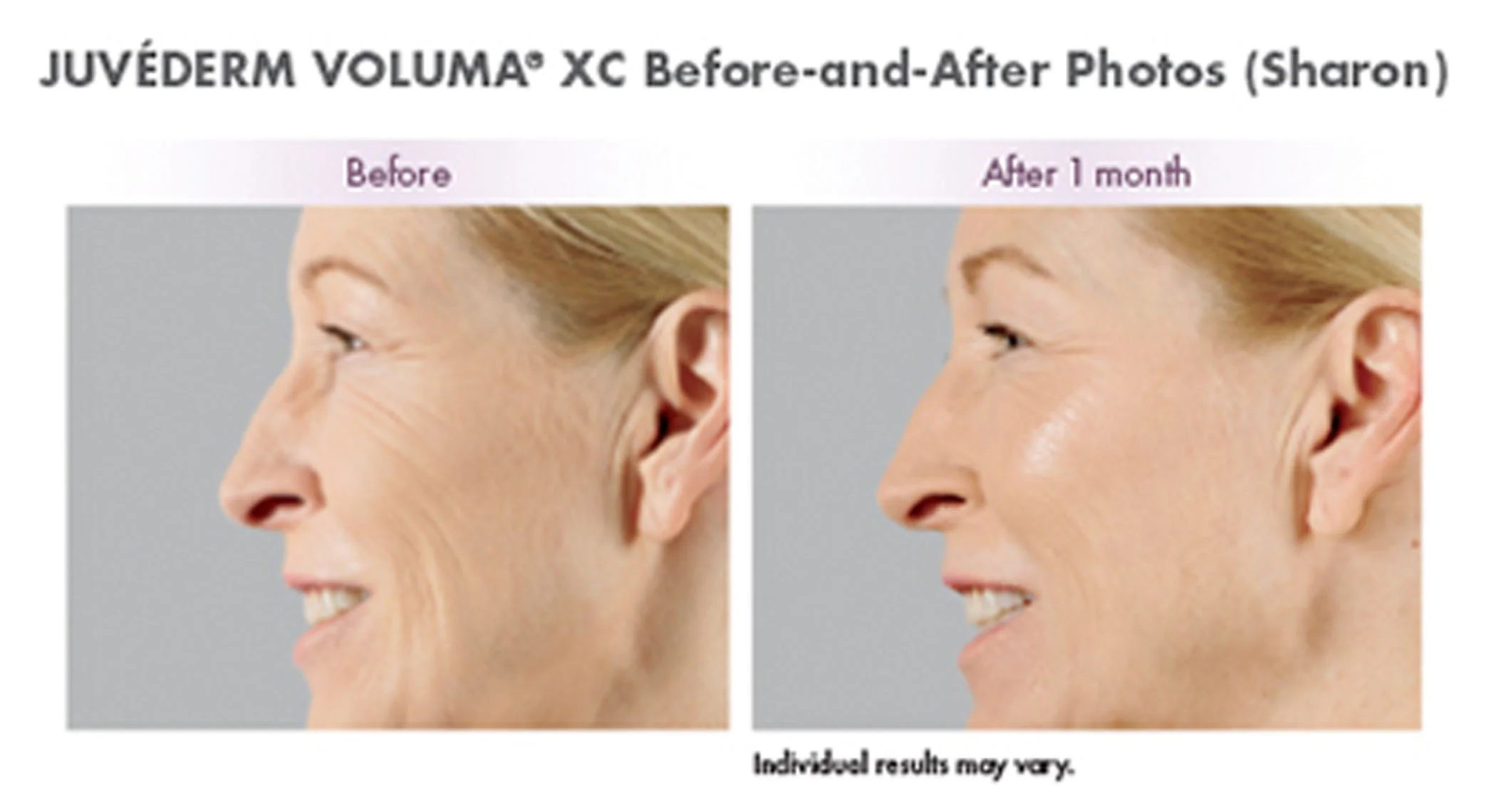 voluma 2.jpg