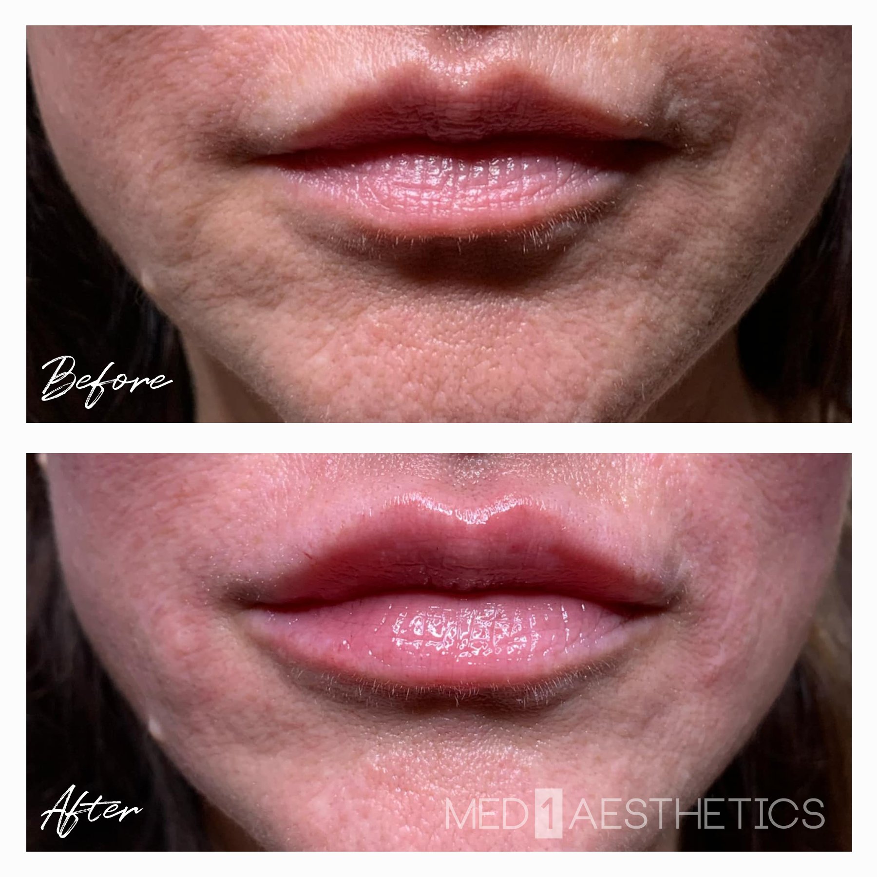 B&A Lips NLF- Alicia.jpg