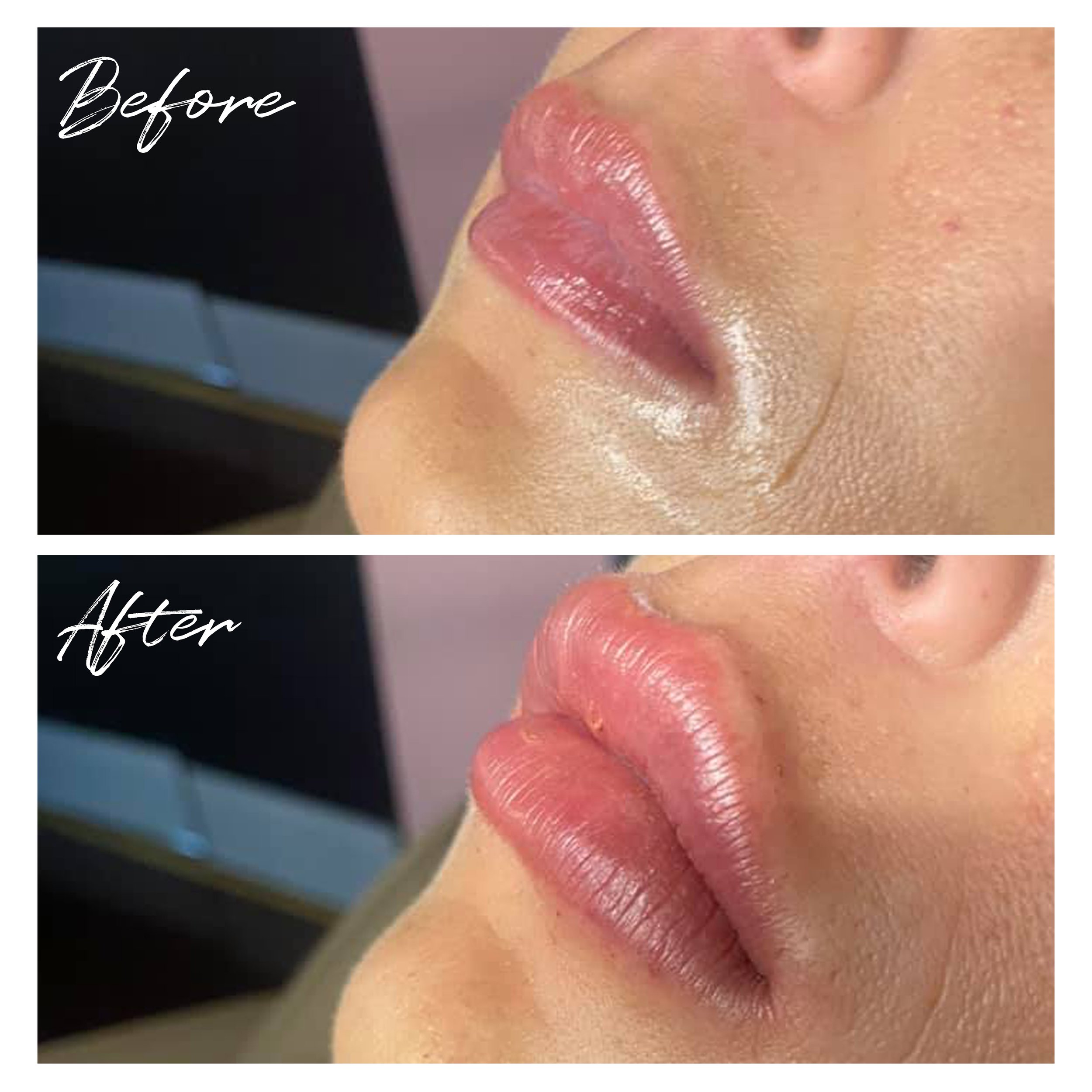 B&A Lips - Doc 4.jpg