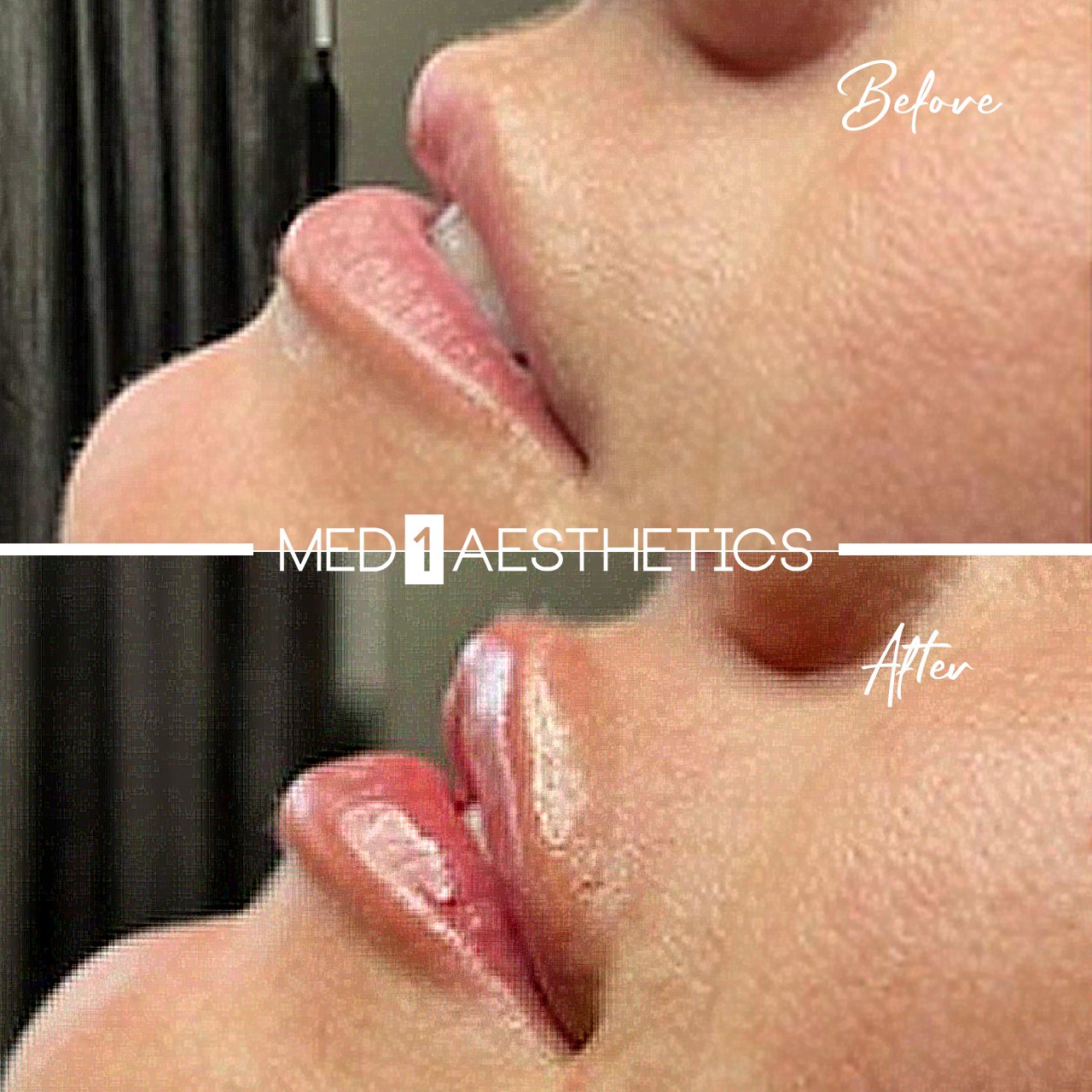 B&A Peggy - Lips 3.jpg