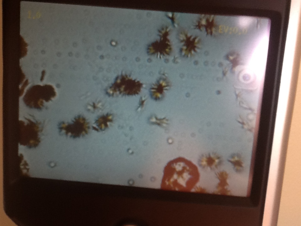 This a photograph of a microscopic view of the calcium oxalate crystals excreted in the urine