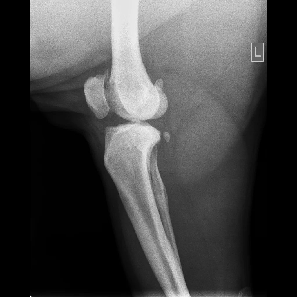 Lower Extremities-Knee Lat-12_23_2015-1_45_25 PM-578.JPEG