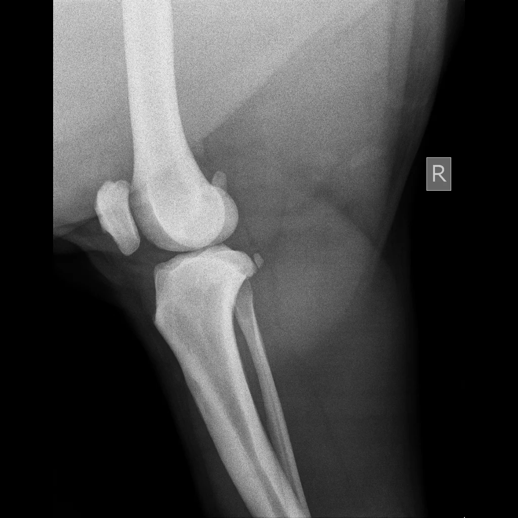 Lower Extremities-Knee Lat-12_23_2015-1_45_26 PM-406.JPEG