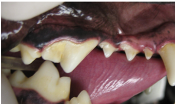 GRADE 1: Tartar build up and sometimes mild gingivitis. There is no bone loss at this stage and we can there for reverse all damage.