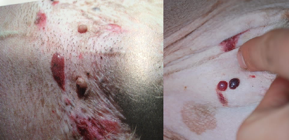 One of these is a haemangioma (benign skin tumour often from sun exposure) the other is a haemangiosarcoma (aggressive skin cancer that can spread to internal organs and can be fatal). Can you tell by looking which is which?