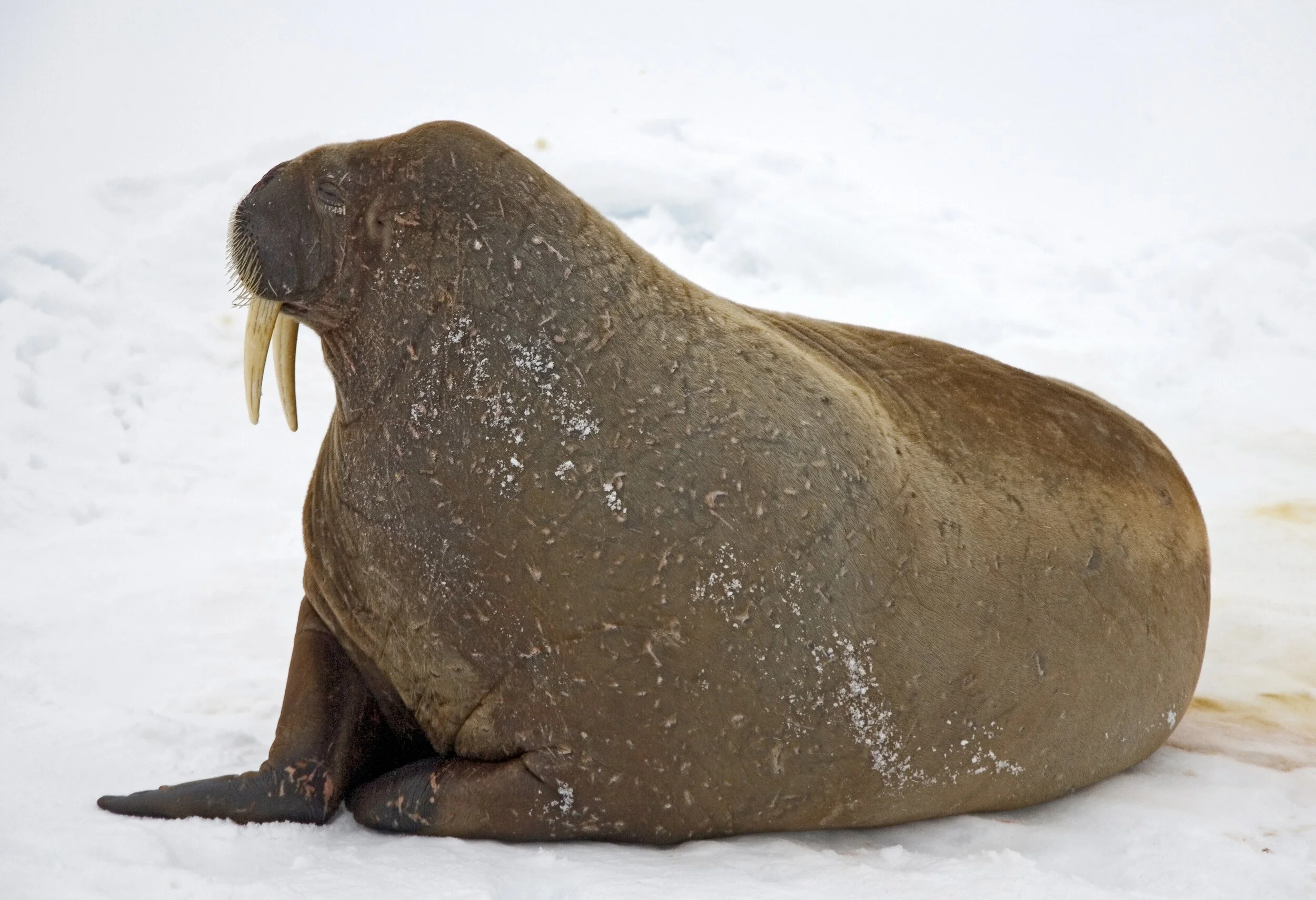 Diary of an Adult Getting Orthodontia — Do I Look Like a Walrus? 