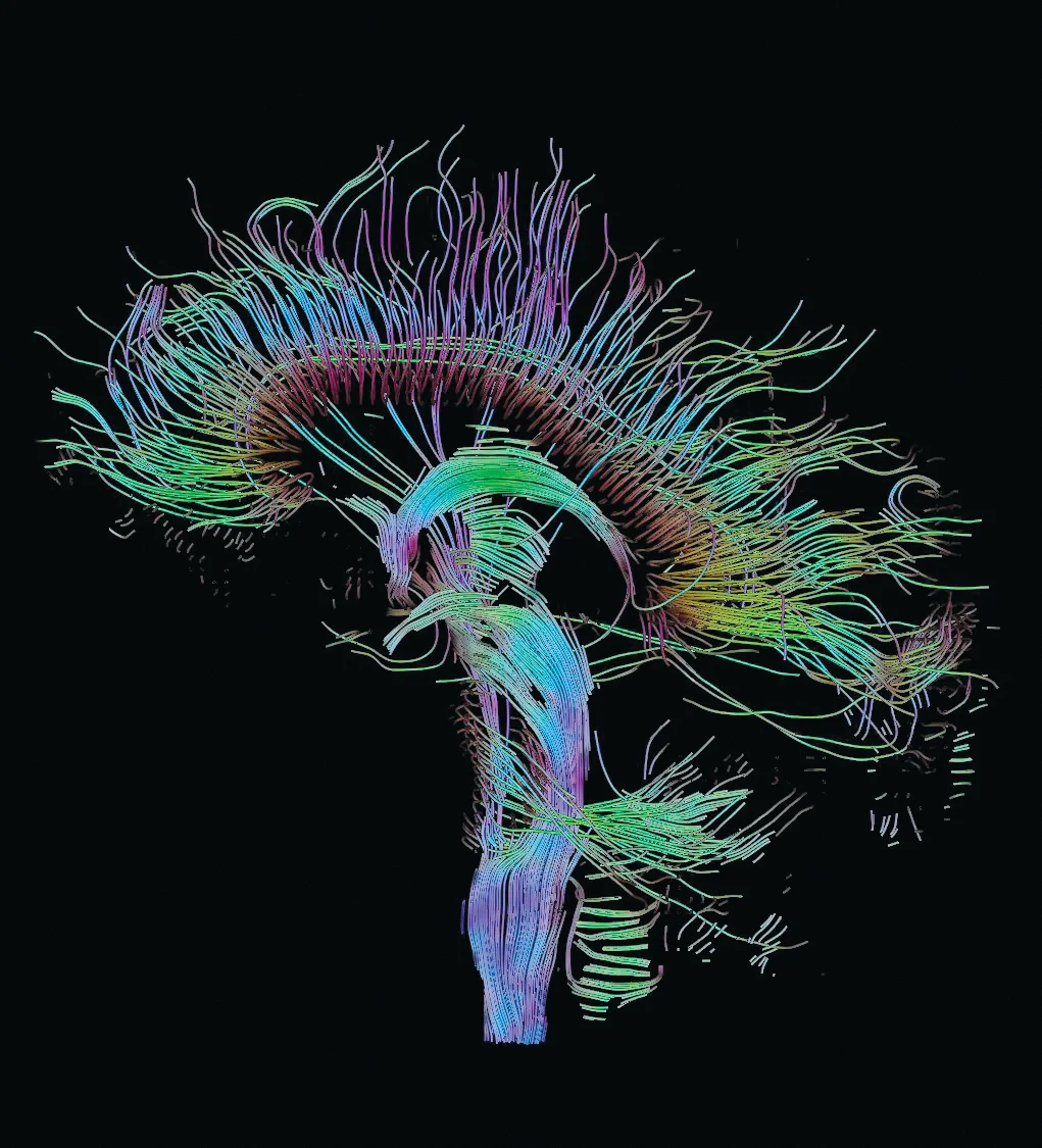 brain.jpg