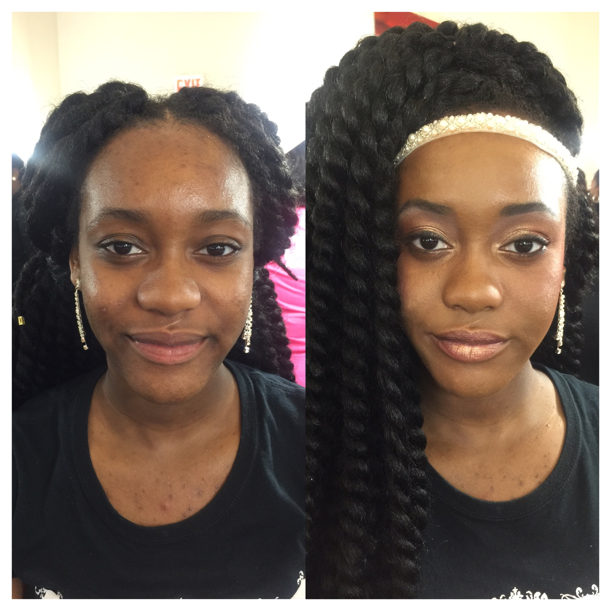#beforeandafter the Dinair Paramedical foundation is amazing for coverage!