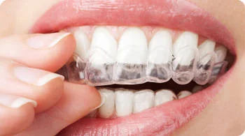The best part about whitening strips are that they're so easy to use. Photo via Humana