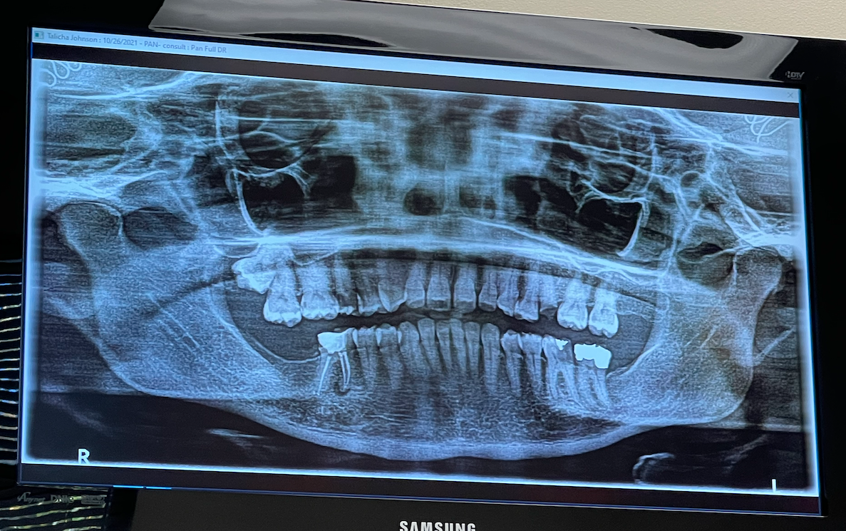 dental scans 2021.png