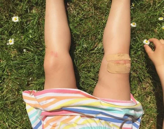 GRAZED KNEES: THE SIGN OF A GOOD WEEKEND
