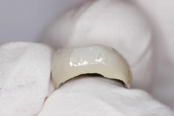 Fig. 8 - The finished proximal contact as it will fit in the patient’s mouth often curves along the adjacent tooth.