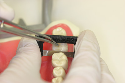Mesial Space