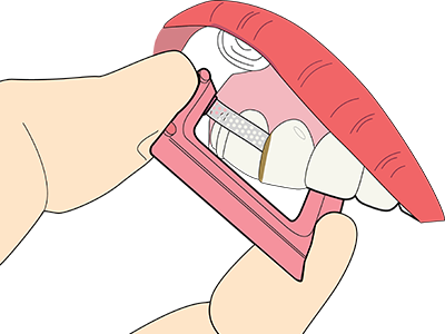 fig1.png