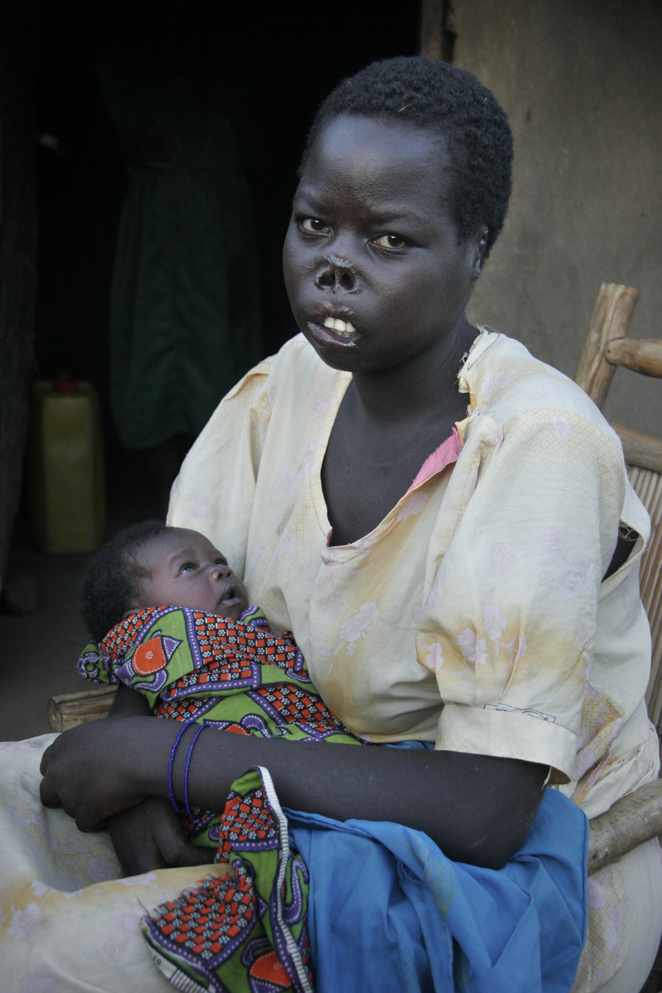 Gulu, Uganda