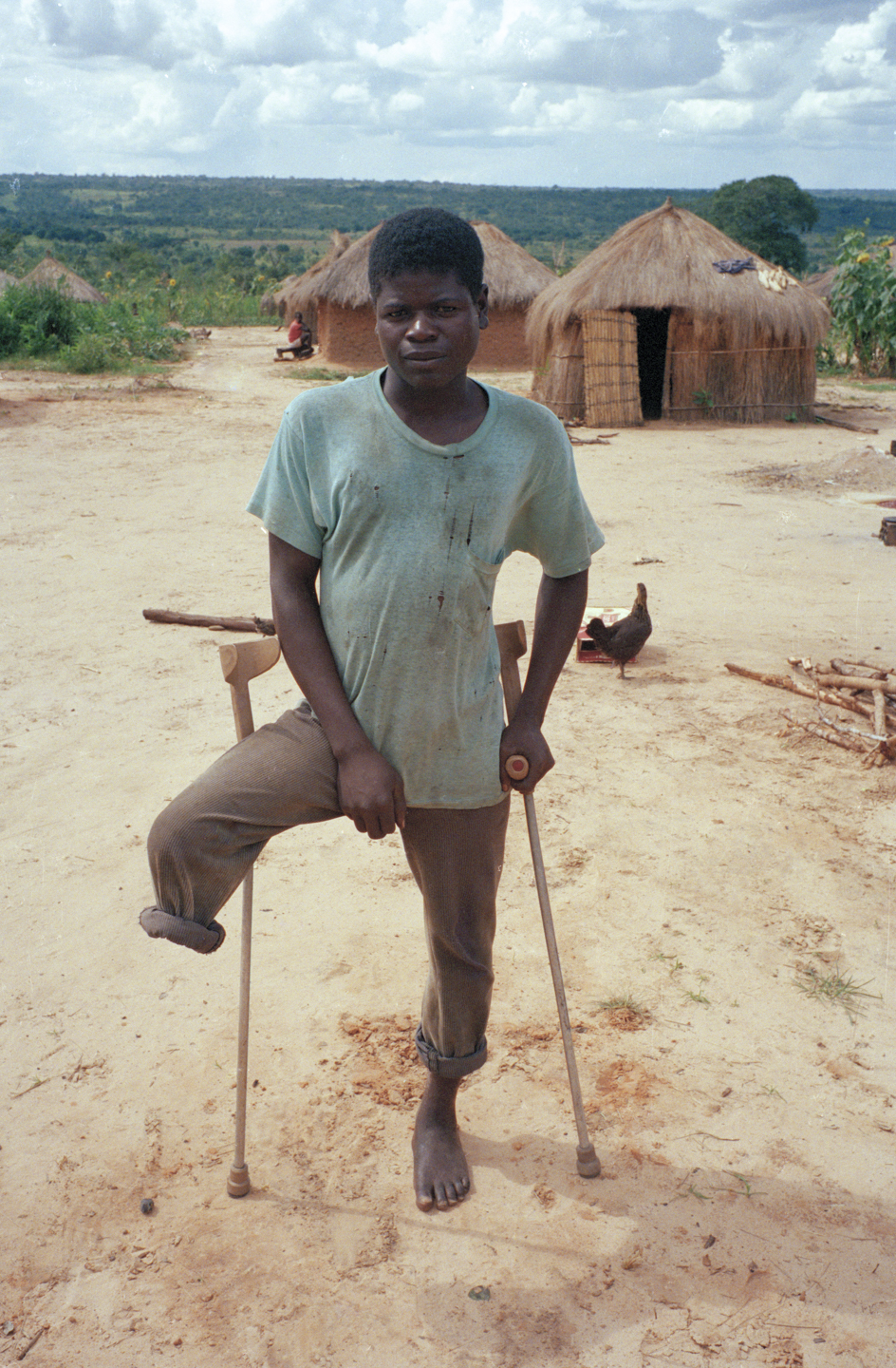 97-67-31_Boy_On_Crutches.jpg
