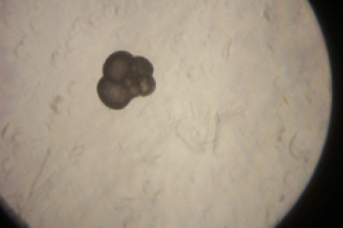 An example of foraminiferal observation during this study (photo credit: C. Davis.)