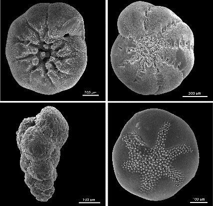 Foraminifera! Photo from Wikimedia Commons
