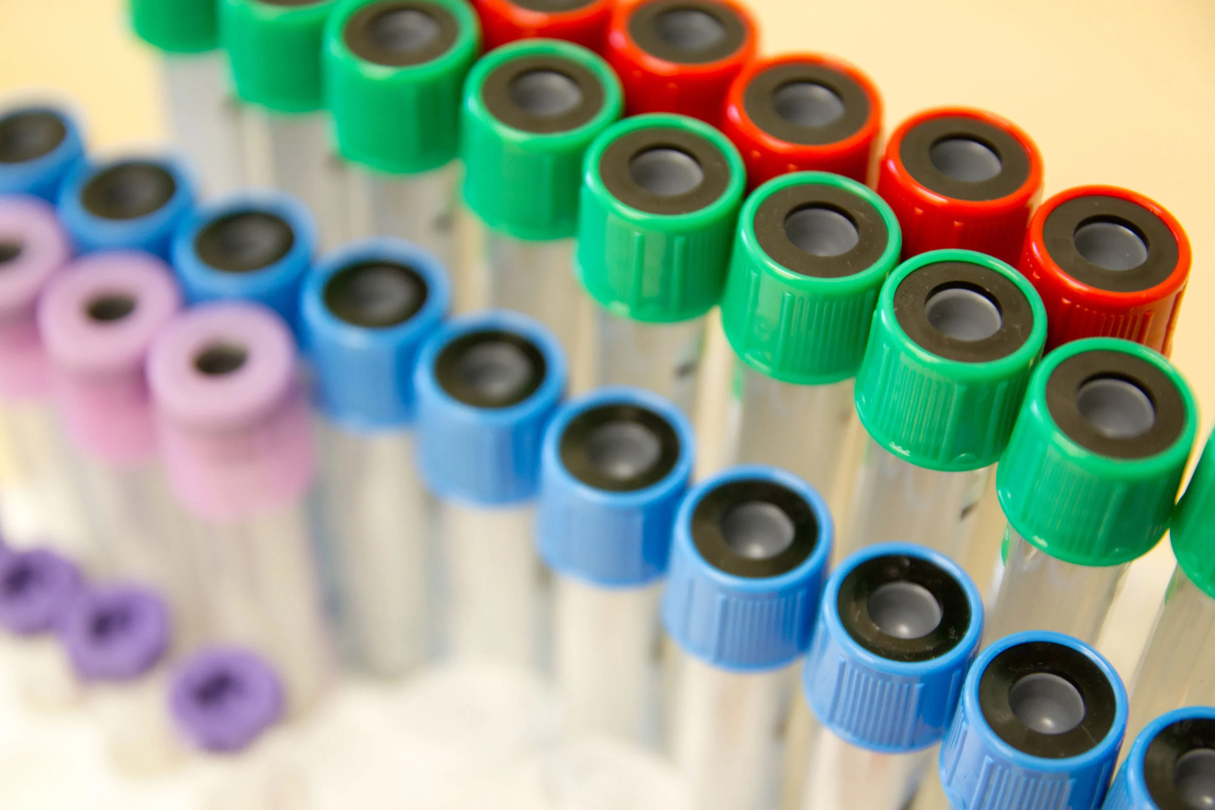 VBV_blood_tubes_dreamstimemaximum_41811398.jpg