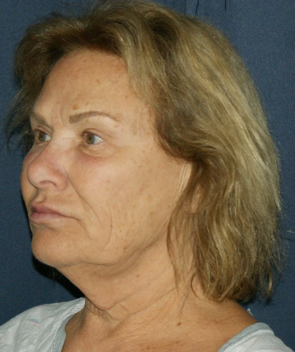 Barb 3-before.jpg